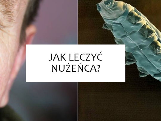 Jak leczyć nużeńca? Sprawdź i zacznij działać