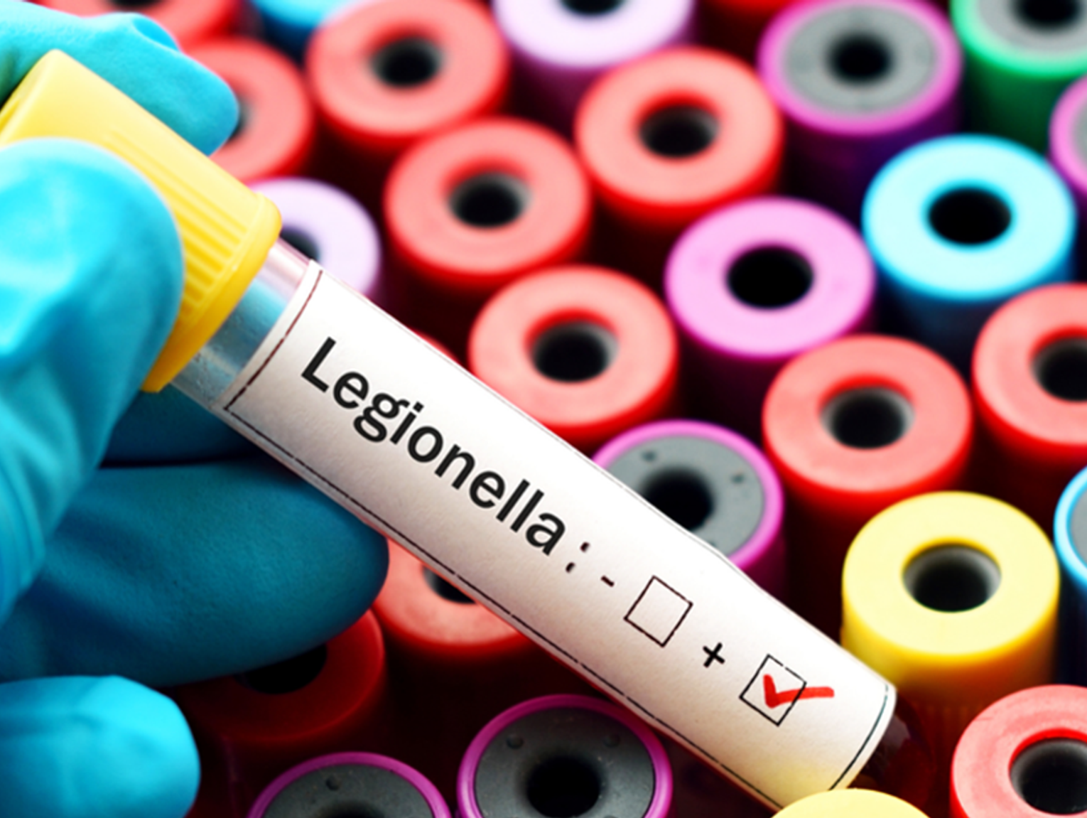 Legionella w wodzie pitnej. Pół szpitala natychmiast zamknięte